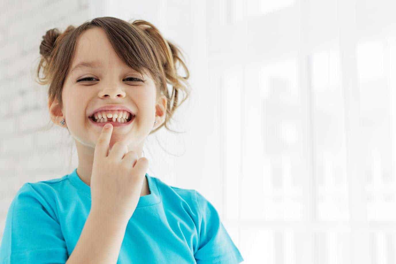 Cute Girl Showing her Broken Teeth | Smile Virtual