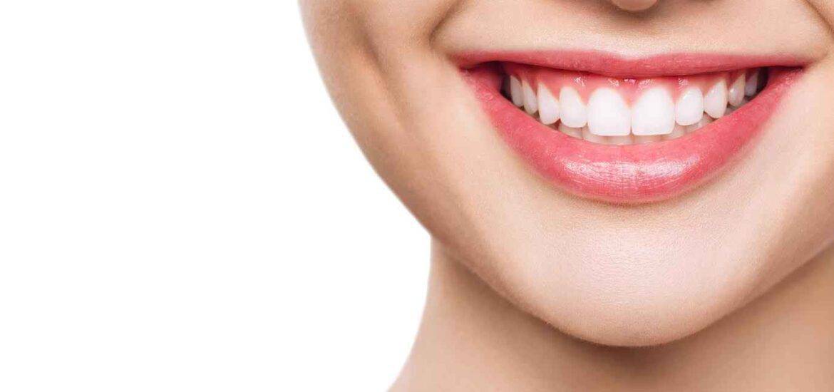 Close up of Dimpled Smile | Smile Virtual