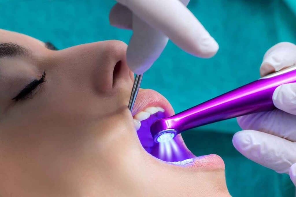 Young Girl Getting Laser Tooth Whitening Treatment | Smile Virtual