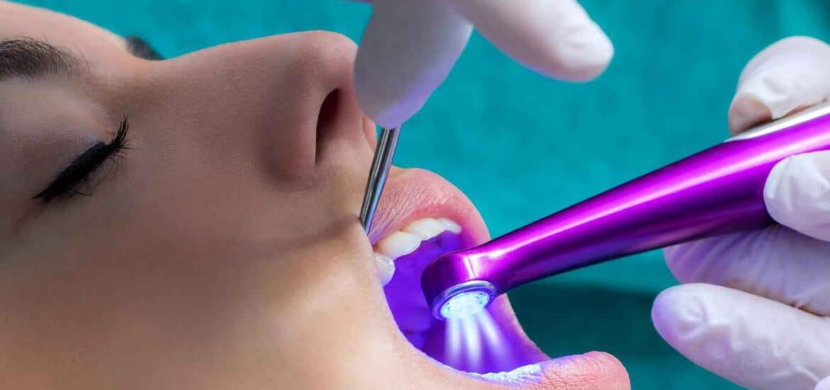 Young Girl Getting Laser Tooth Whitening Treatment | Smile Virtual
