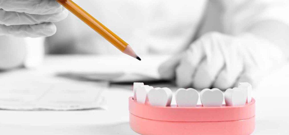 Artificial Teeth Dentures Model | Smile Virtual