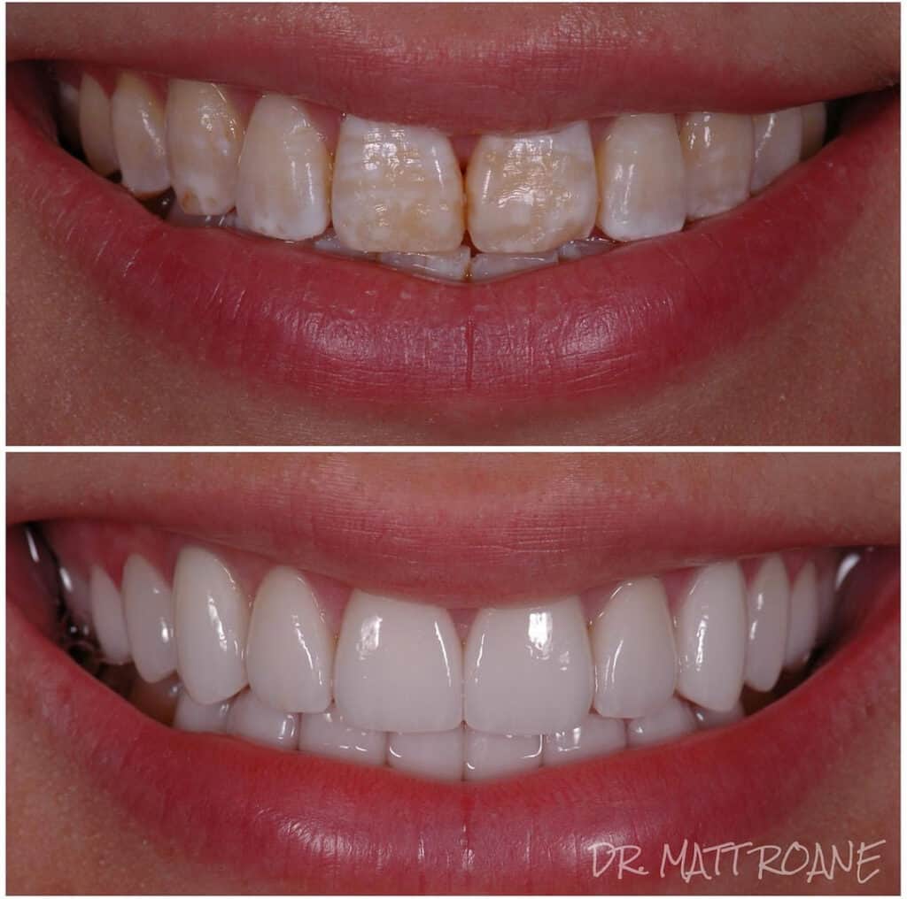 Smile Transformation by Smile virtual
