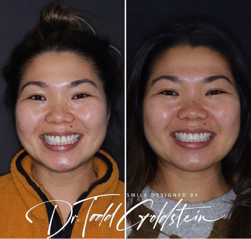 Cosmetic Dentistry By Smile Virtual