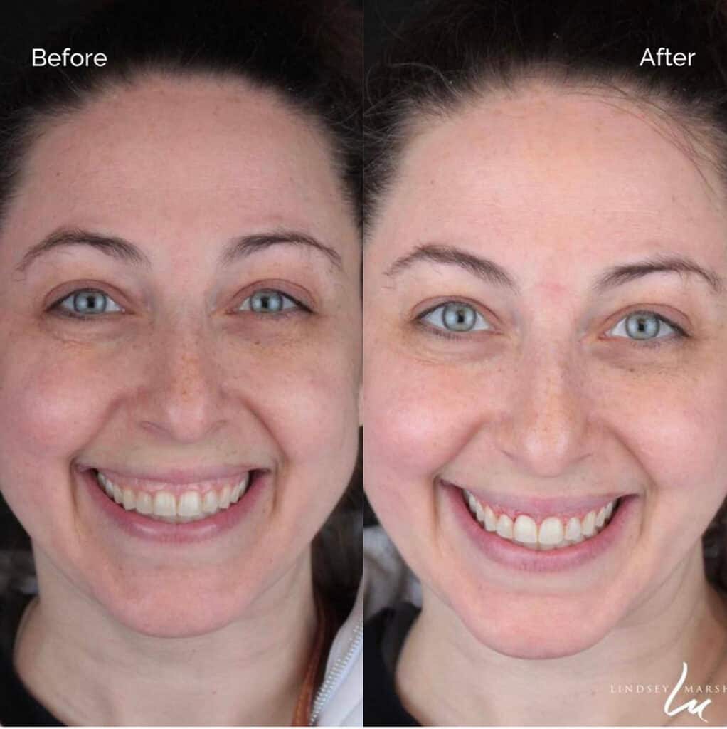 Dazzling Smile By Smile Virtual