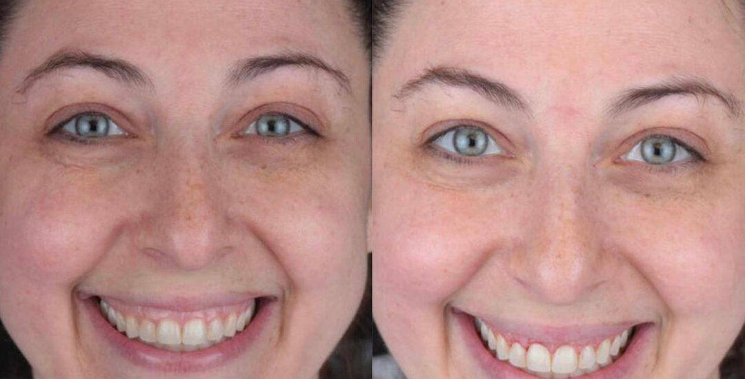 Dazzling Smile By Smile Virtual