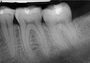 digital-radiography