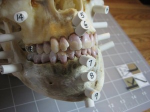 dental-forensics