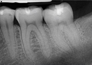 digital-radiography