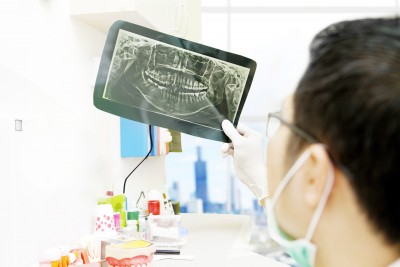 oral-cancer